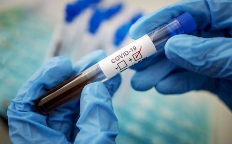 Kyrgyzstan reports 163 new COVID-19 cases. 3519 in total