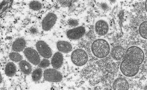 Vietnam records second monkeypox case
