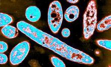 WHO: Legionnaires' disease kills five in Portugal